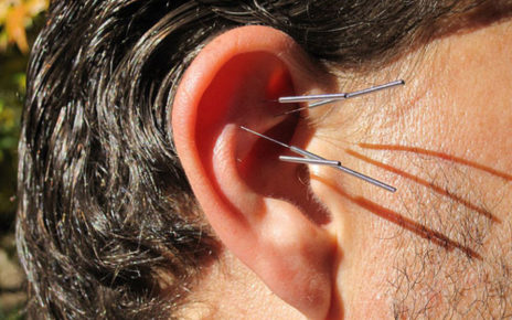 Bisakah Terapi Akupunktur Untuk Gangguan Pendengaran?