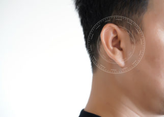 Apa itu Gangguan Pendengaran Sensorineural?