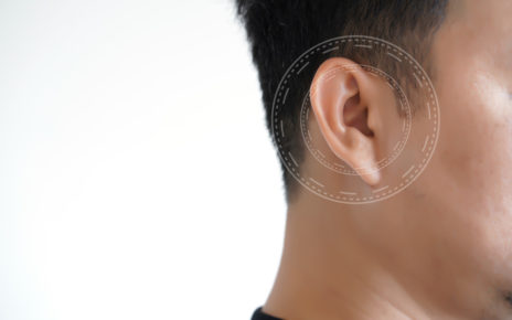 Apa itu Gangguan Pendengaran Sensorineural?