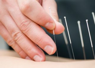 Terapi Akupunktur Untuk Mengatasi Gangguan Pendengaran dan Tinnitus
