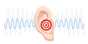 Tinnitus Dan Kotoran Telinga, Apakah Saling Terkait? 